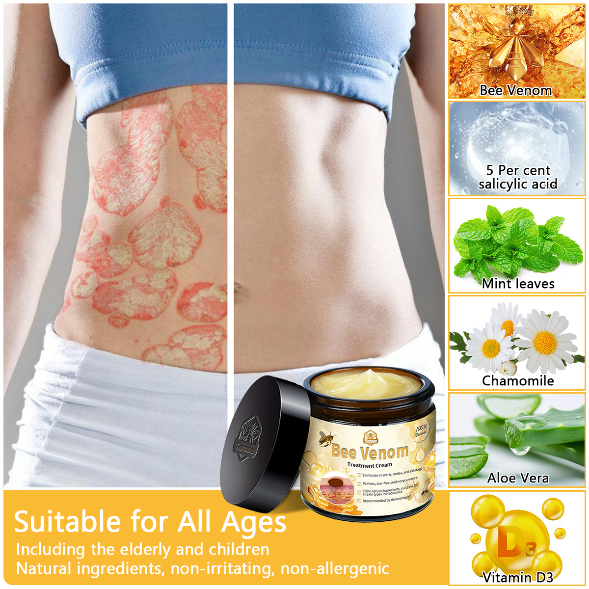 πποΌπ΄π΄π· π
πππππππππποΌππ’ππππ’β’ Bee Venom Skin Treatment Cream(π₯Last day promotion 80% off)