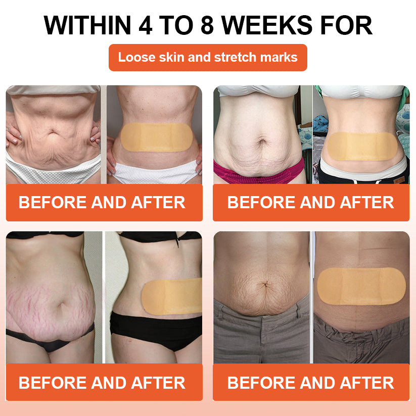 Official Store: ThermoMagnetic Fat-Burning Patch🎄, Approved by The Obesity Society (TOS) (Helps with fat loss, improves blood circulation, relieves muscle soreness, reduces swelling, eases stress, and supports body metabolism)