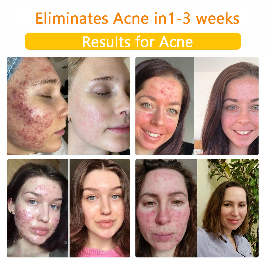 πποΌπ΄π΄π· π
πππππππππποΌππ’ππππ’β’ Bee Venom Skin Treatment Cream(π₯Last day promotion 80% off)