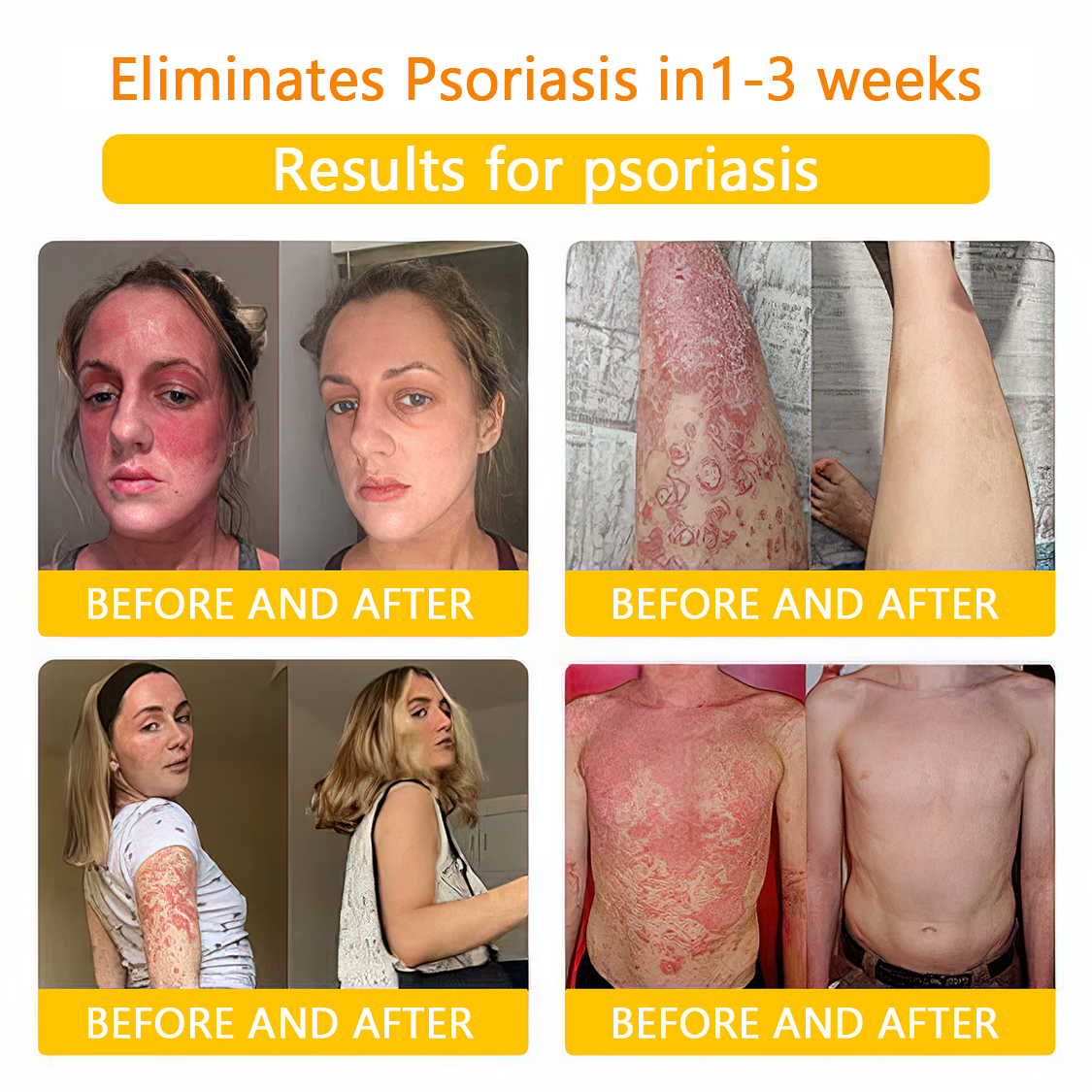 πποΌπ΄π΄π· π
πππππππππποΌππ’ππππ’β’ Bee Venom Skin Treatment Cream(π₯Last day promotion 80% off)