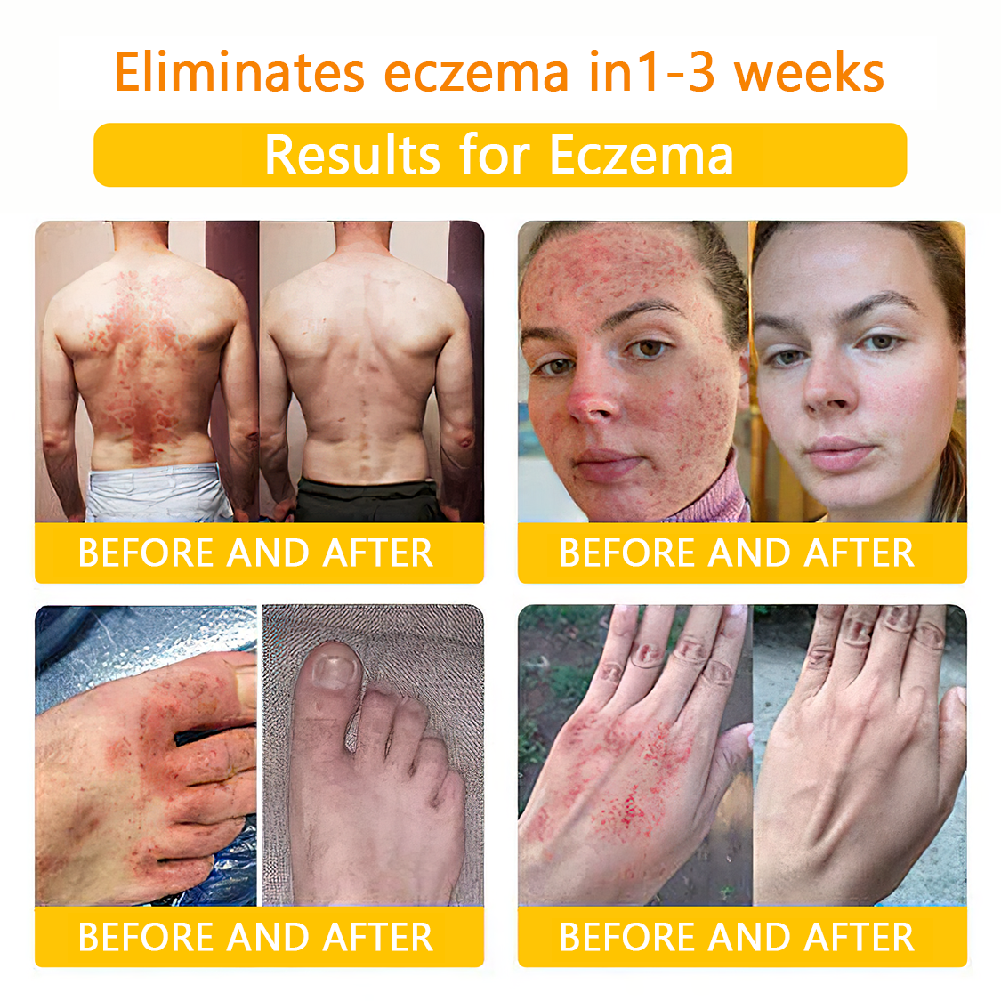 πποΌπ΄π΄π· π
πππππππππποΌππ’ππππ’β’ Bee Venom Skin Treatment Cream(π₯Last day promotion 80% off)