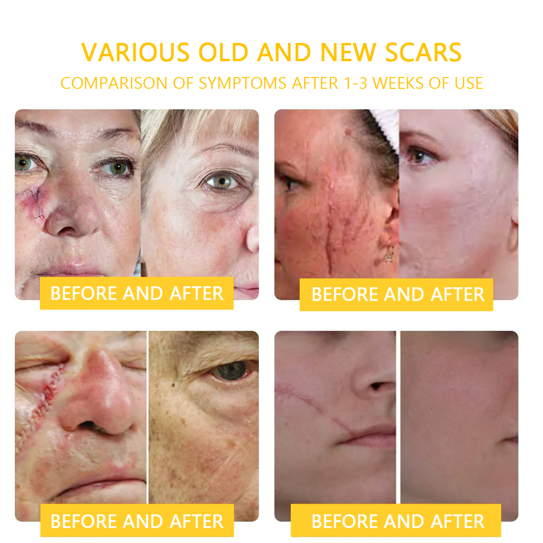 πποΌπ΄π΄π· π
πππππππππποΌππ’ππππ’β’ Bee Venom Skin Treatment Cream(π₯Last day promotion 80% off)