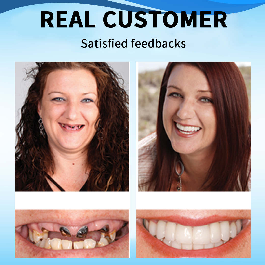 TIMNAMY™ Silicone Reline Denture Set 🎁
