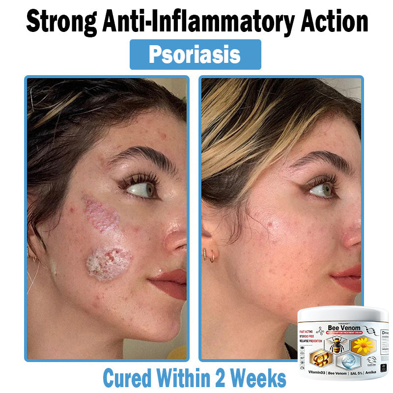 TODAHOF™ Bee Venom Multi-Symptom Skin Treatment Cream (🛡️NPF RECOMMENDS)