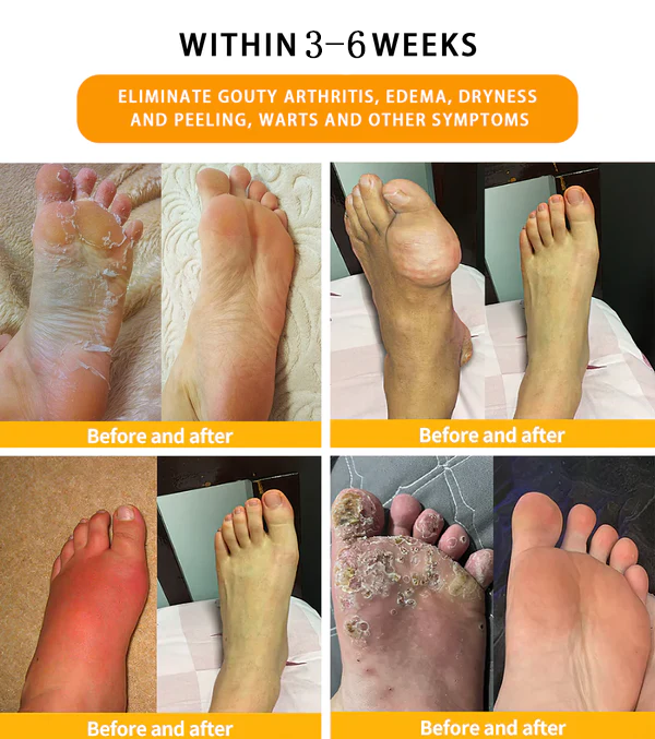 Lenreey™ 30-Herb Slimming & Detox Foot Bath Beads-🏥(LANACertification Lymphatic Association of America)