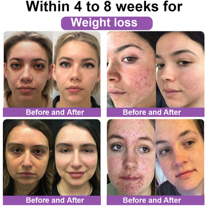 NAD+ Natural Repair Vaginal Capsules--National Institutes of Health（NIH）Approved(Targeted at solving women’s problems - gynecological diseases, firming skin, acne and various hormonal imbalances)✨