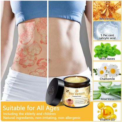🎉🎉（𝐴𝐴𝐷 𝑅𝑒𝑐𝑜𝑚𝑚𝑒𝑛𝑑𝑒𝑑）𝑇𝑢𝑟𝑜𝑛𝑢™ Bee Venom Skin Treatment Cream(🔥Last day promotion 80% off)