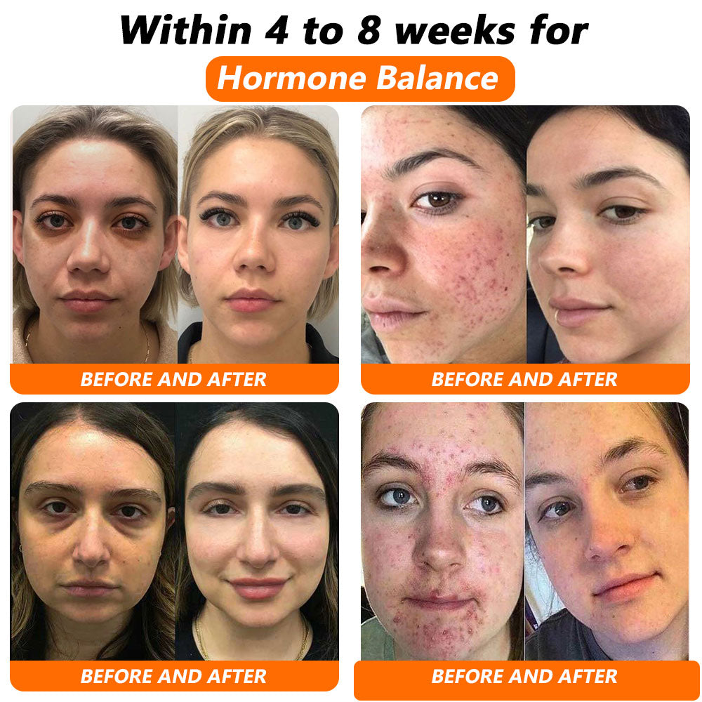 𝖢𝗏𝗋𝖾𝗈𝗓® 𝖡𝖾𝖾 𝖵𝖾𝗇𝗈𝗆 𝖭𝖠𝖣 𝖭𝖺𝗍𝗎𝗋𝖺𝗅 𝖱𝖾𝗉𝖺𝗂𝗋 𝖢𝖺𝗉𝗌𝗎𝗅𝖾𝗌 [𝖥𝗈𝗋 𝖺𝗅𝗅 𝗏𝖺𝗀𝗂𝗇𝖺𝗅 𝖺𝗇𝖽 𝗁𝗈𝗋𝗆𝗈𝗇𝖺𝗅 𝗉𝗋𝗈𝖻𝗅𝖾𝗆𝗌] 👩‍⚕️